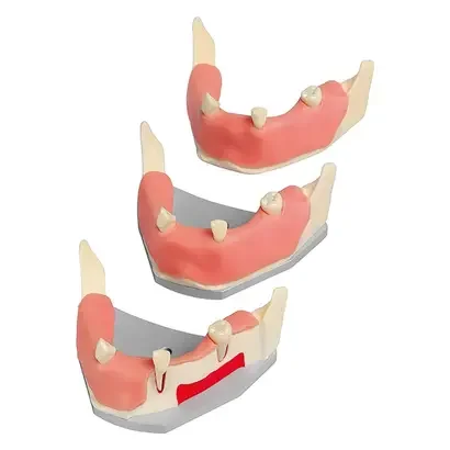 denta-tec-120260711000742720513