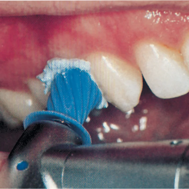 denta-tec-120260711085711795515