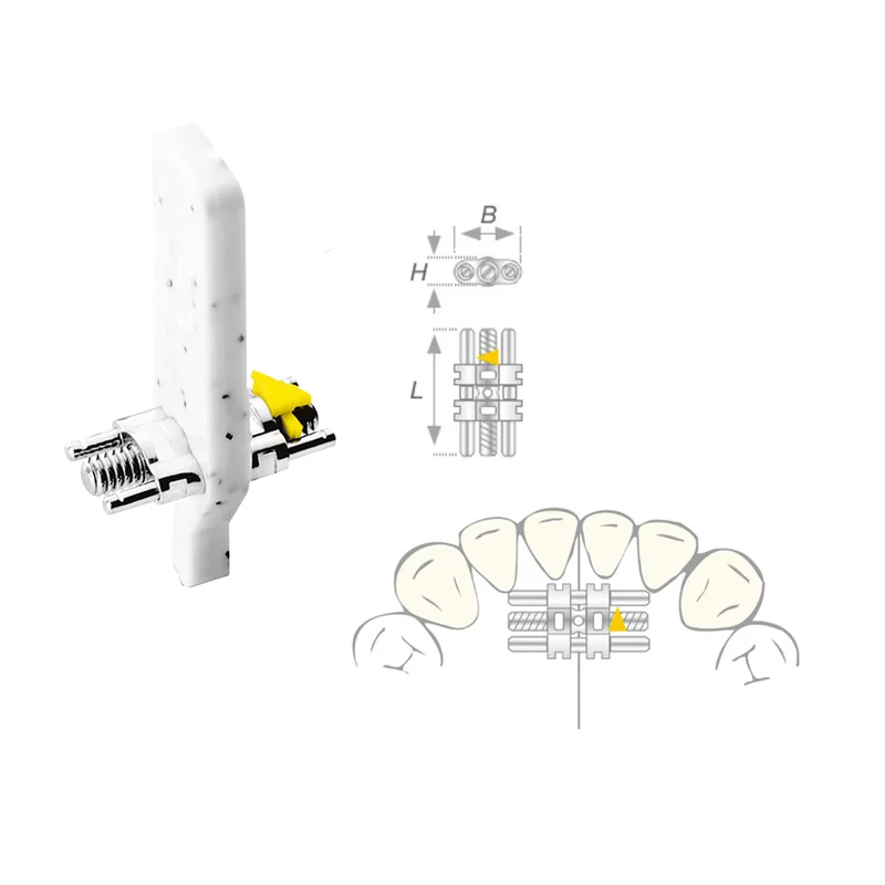 denta-tec-120260711144940836772
