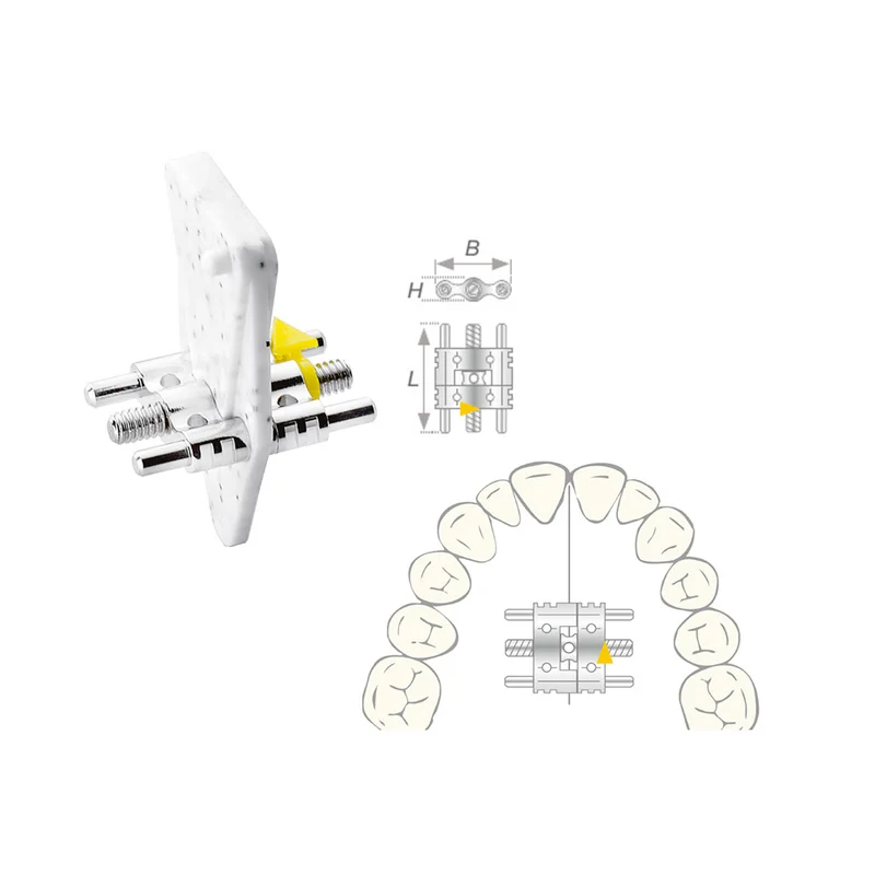 denta-tec-1202607122007201007263